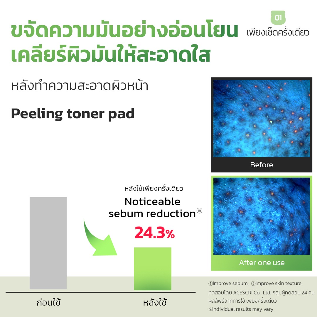 FRUDIA Green Grape Pore Peeling Pad 1pc โทนเนอร์แพดลดสิวเสี้ยน กระชับรูขุมขน