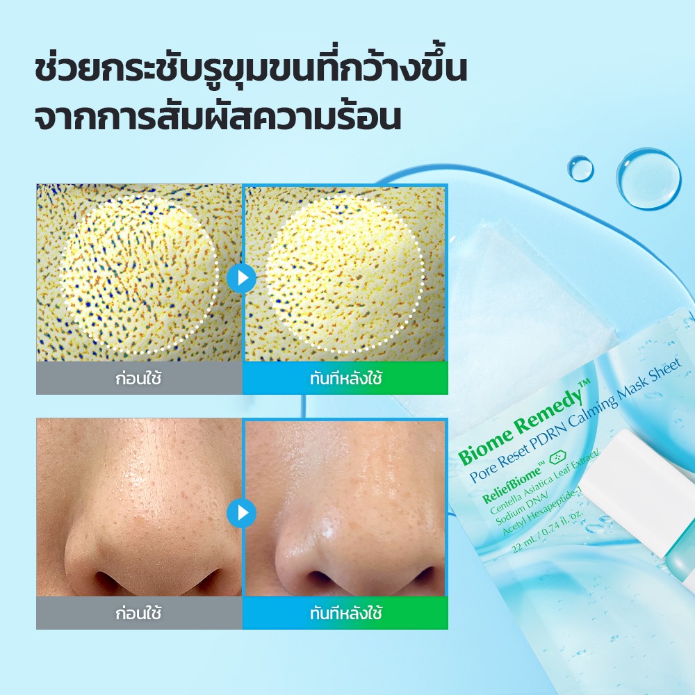 UIQ Biome Re. Pore Reset PDRN Calming Sheet Mask แผ่นมาสก์หน้า