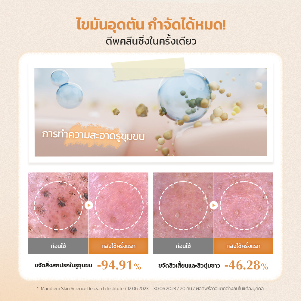 UIQ Biome Barrier Collagen Firming Cleansing Balm คลีนซิ่งบาล์ม ล้างเมคอัพ ดีพคลีนซิ่ง เสริมกำแพงผิว คอลลาเจน (แถม 10ml)