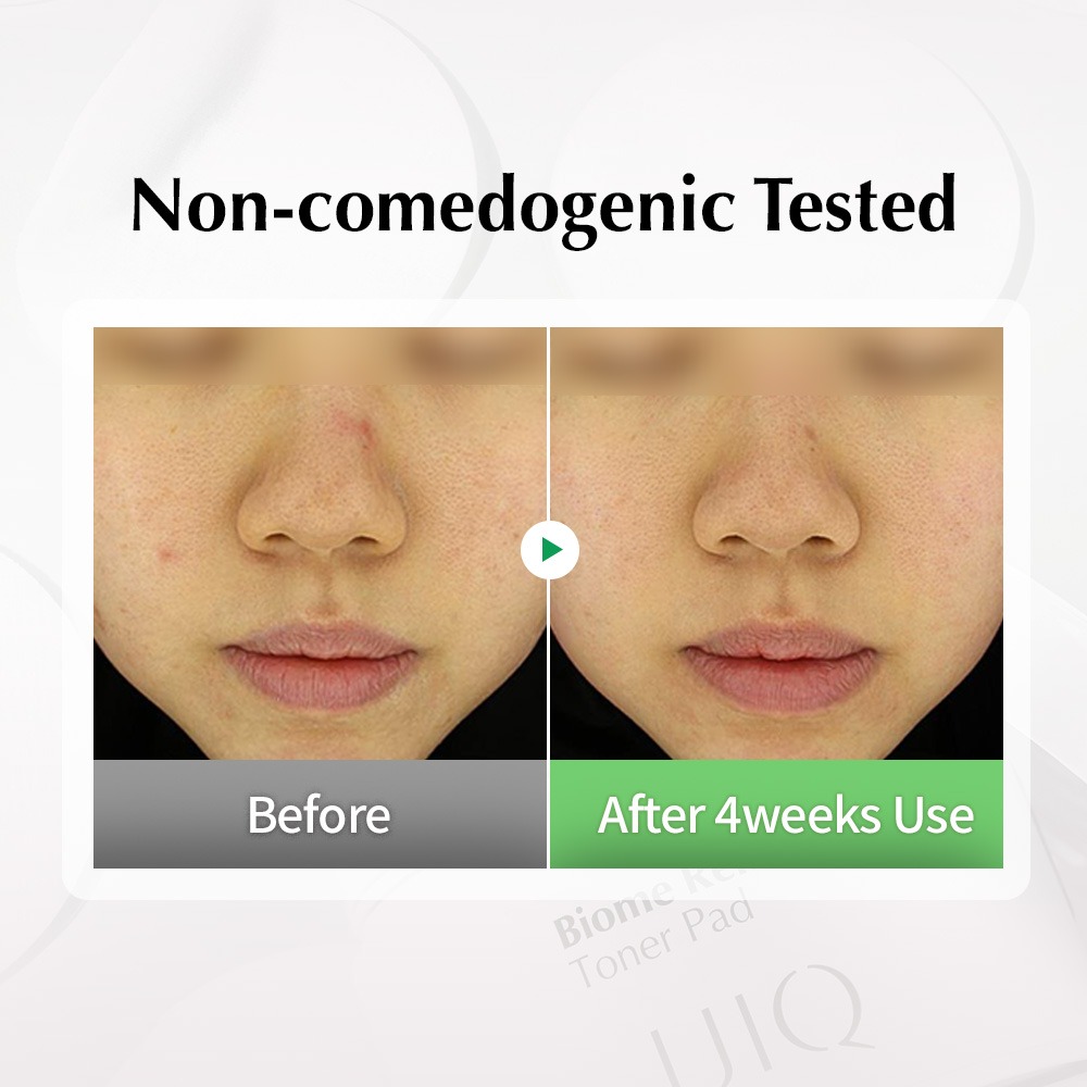 UIQ Biome Re. Toner Pad แผ่นโทนเนอร์ ผลัดเซลล์ผิว ผิวแพ้ง่าย รูขุมขน (แถมของสะสม RIIZE)