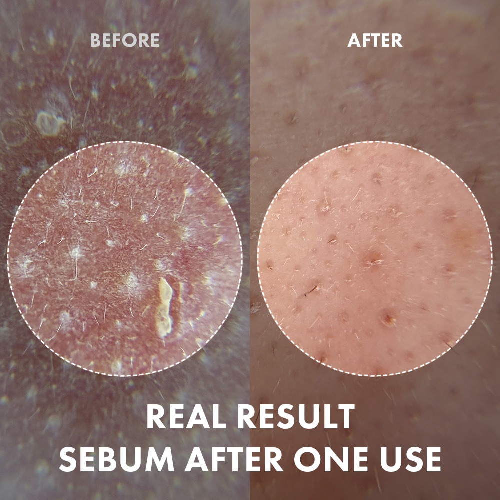 NUKIT Peeling Ampoule พีลลิ่งแอมพูล 5 สูตร