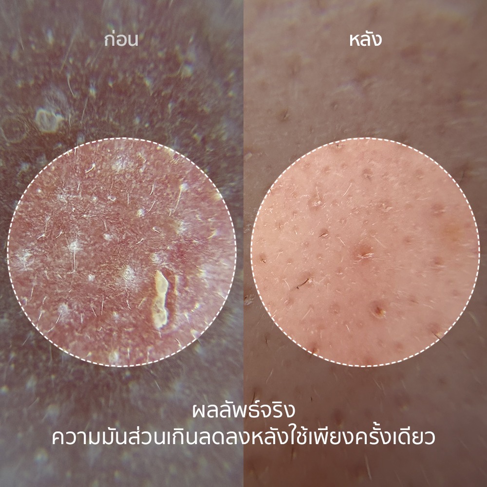 NUKIT Radiant Peeling Ampoule แอมพูลผลัดเซลล์ผิว หน้าใส ลดจุดด่างดำ ผิวโกลว์ ขัดผิว